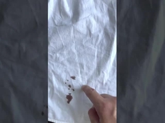 Detergent Industry Alkaline Protease